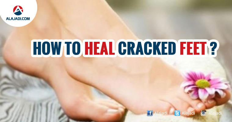 how-to-heal-cracked-feet