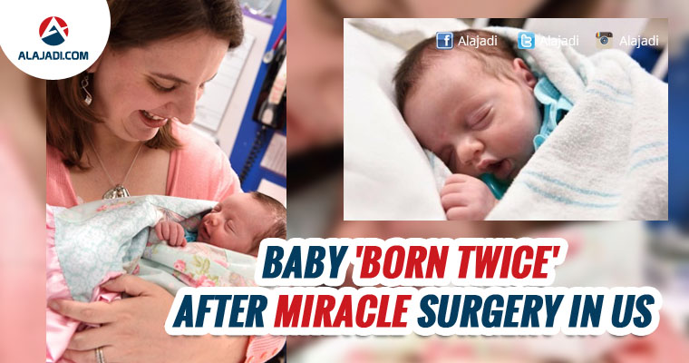 baby-born-twice-after-miracle-surgery-in-us